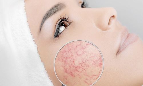 Capture d’écran 2022-07-19 à 17.04.03