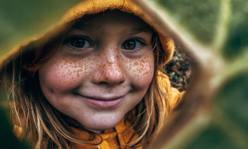 image d'une petite fille avec des tâche de pigmentation sur le visage