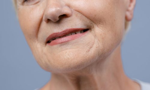 image d'une bouche de femme possédant des rides